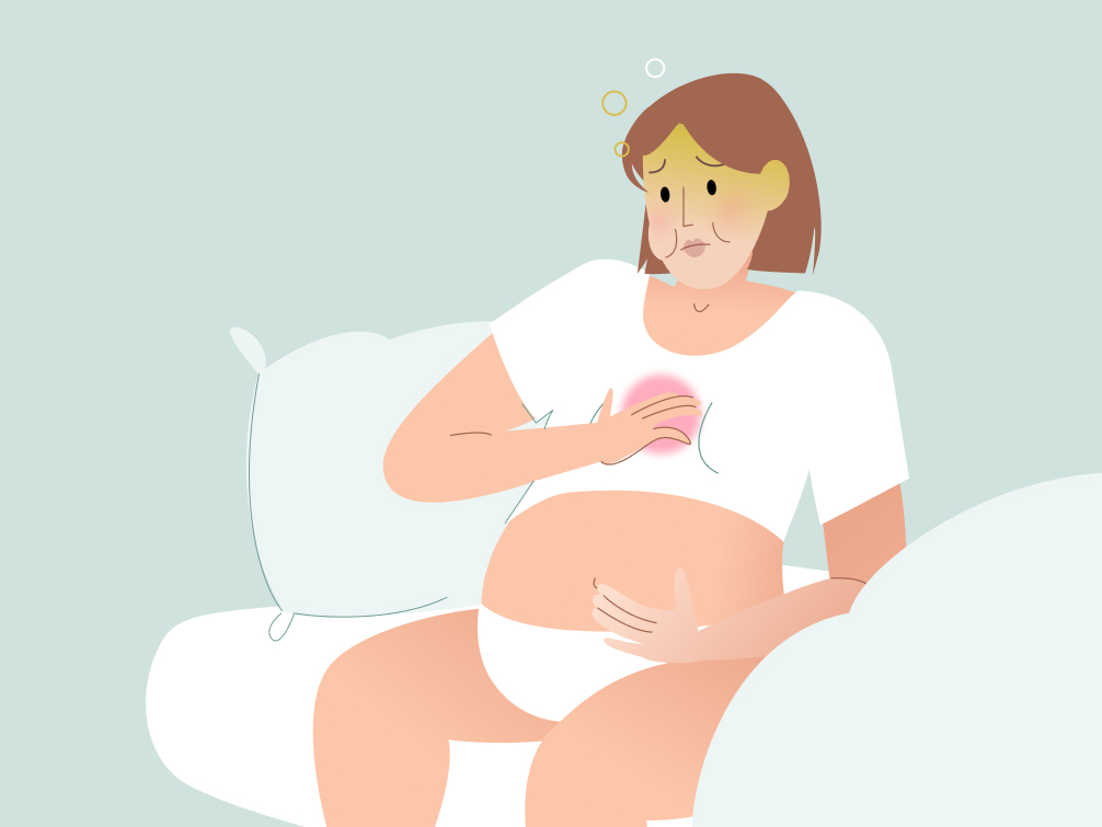 7222 Heartburn during pregnancy