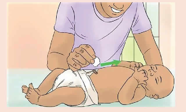 Umbilical cord care